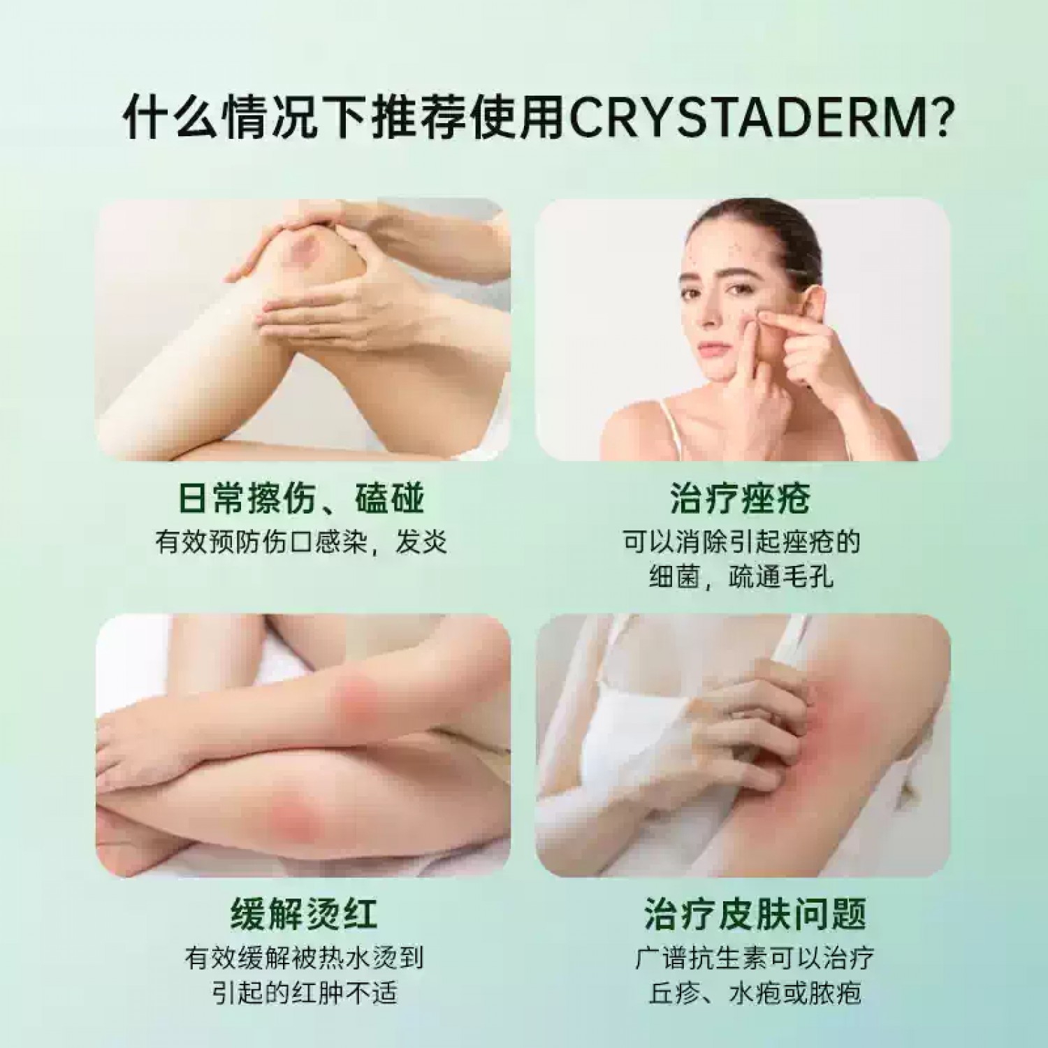 新西兰进口Crystaderm过氧化氢抗菌霜10g祛痘割伤擦伤